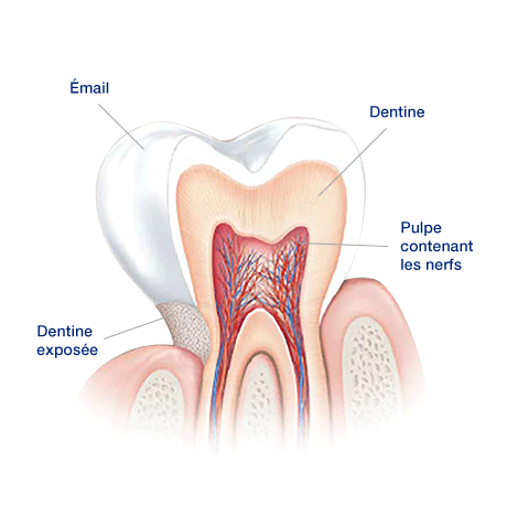 Quelles sont les causes de la sensibilité dentaire ? Quelles sont les causes de la sensibilité dentaire ?